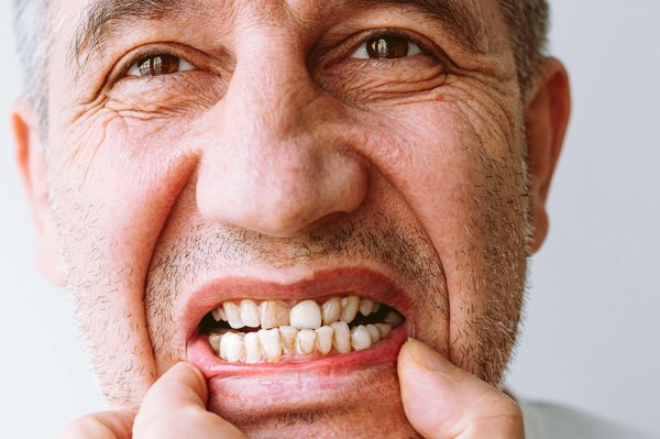 Comment soulager la douleur d'une dent cassée ?